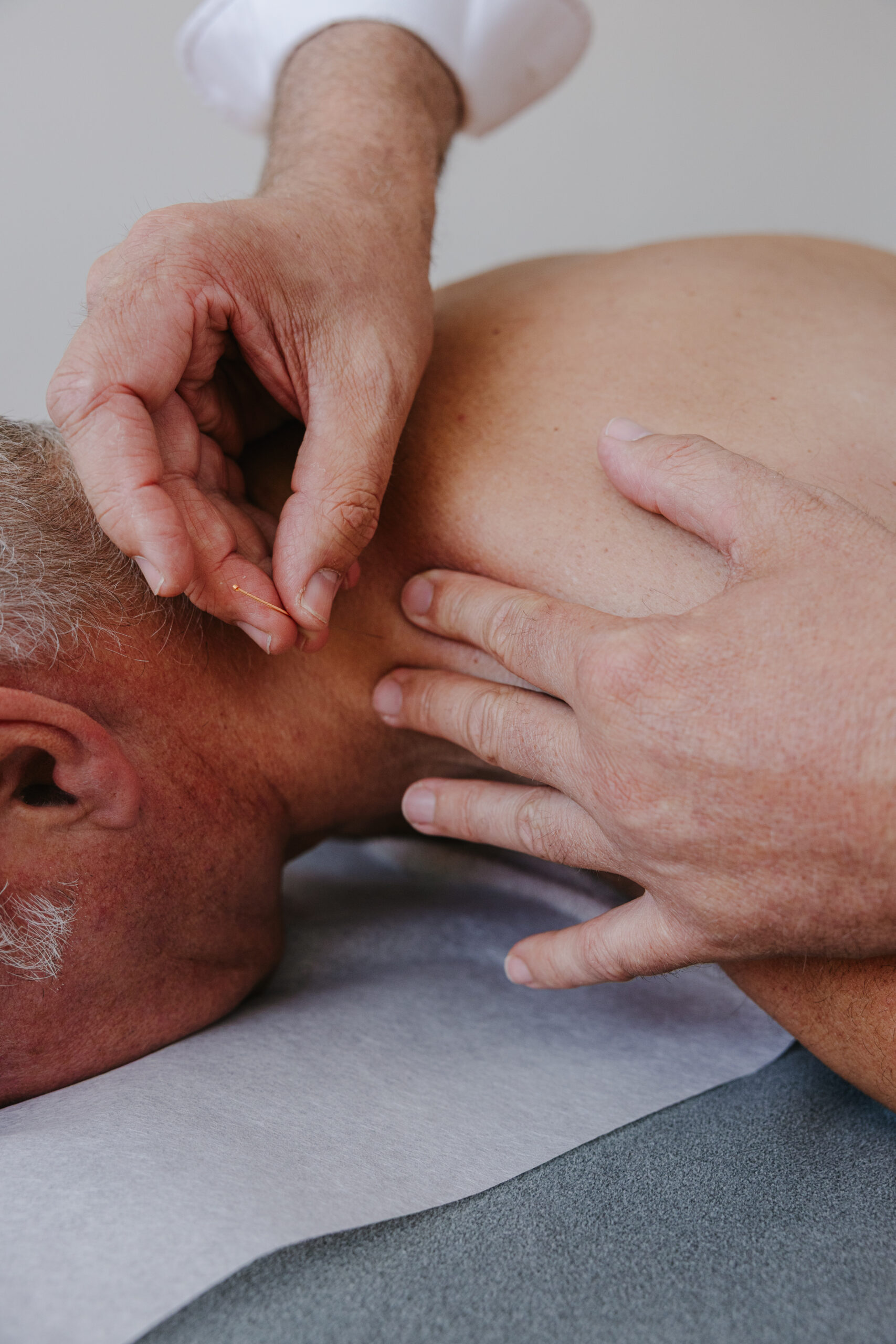 dry needling kinesitherapie praktijk savoir ieper scaled
