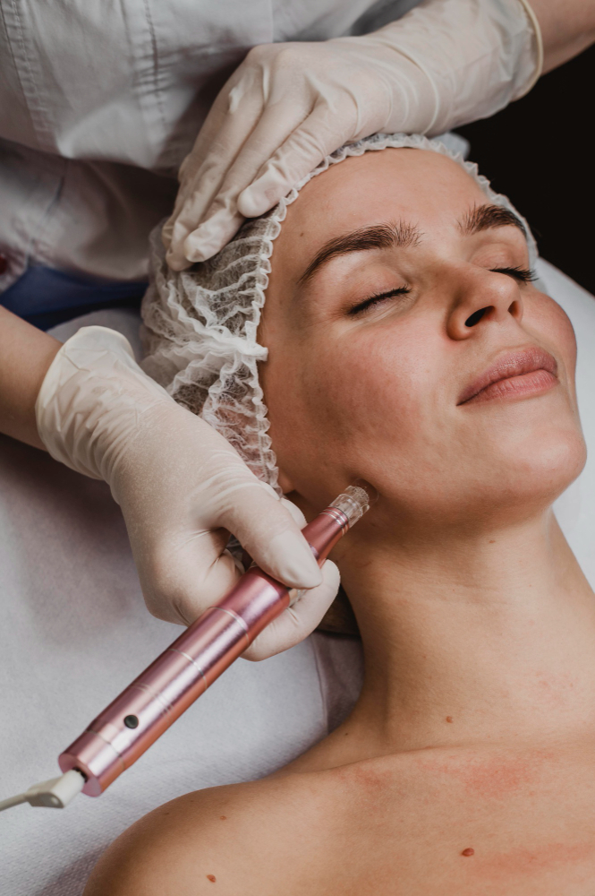 microneedling praktijk savoir huidzorg ieper